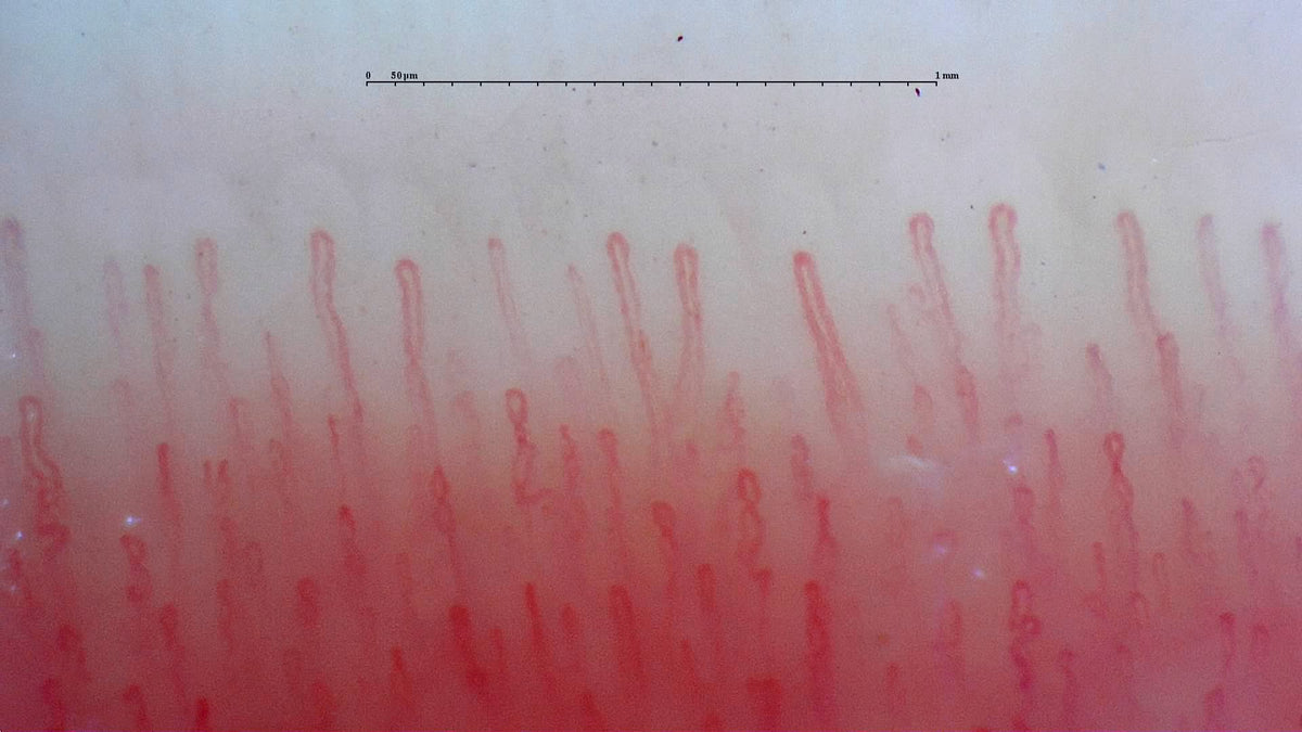 Tienda de capilaroscopia de Capillary.io – Capillaroscopy Store