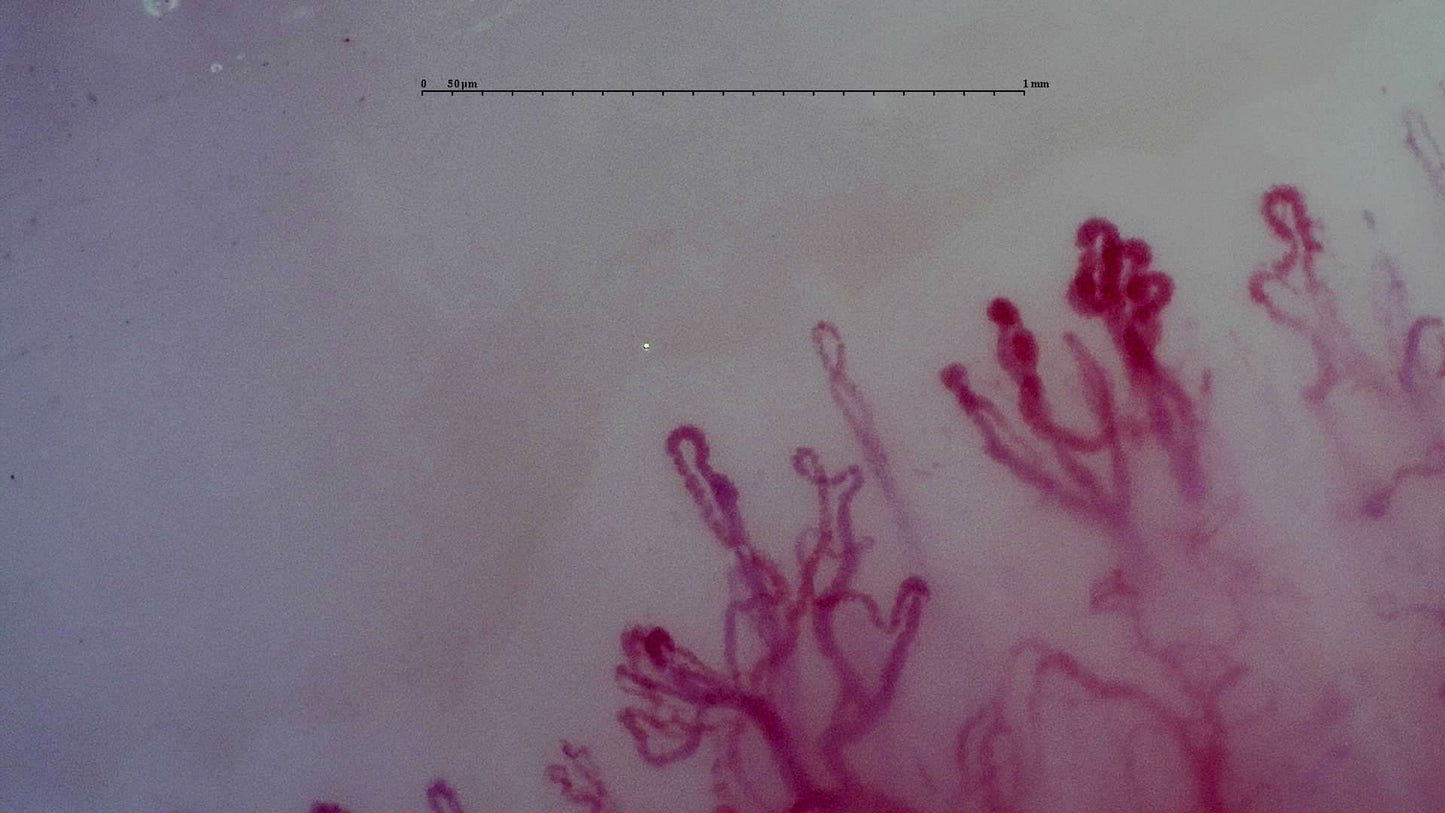 Smart G-Scope Capillaroscope - Nailfold Capillaroscopy Package